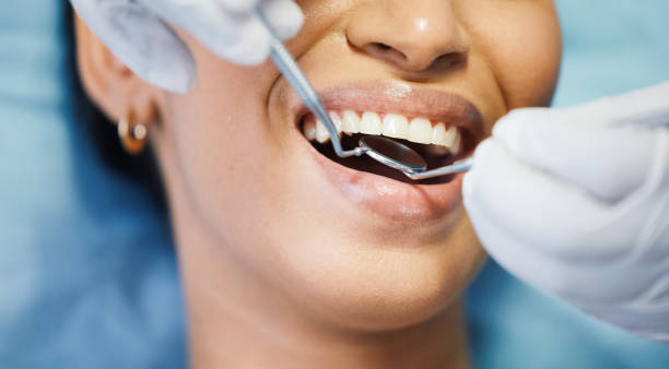 Best Emergency Wisdom Teeth Removal in Baltic, CT