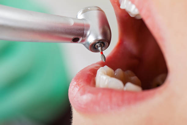 Best Cosmetic Emergency Dentistry in Baltic, CT